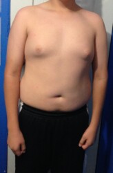 After